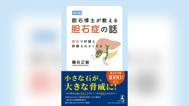 あなたは大丈夫!? 胆石によって肝臓も膵臓もわるくなる…!? まずは胆石ができる原因を知ることから始めよう|ゴールドライフオンライン