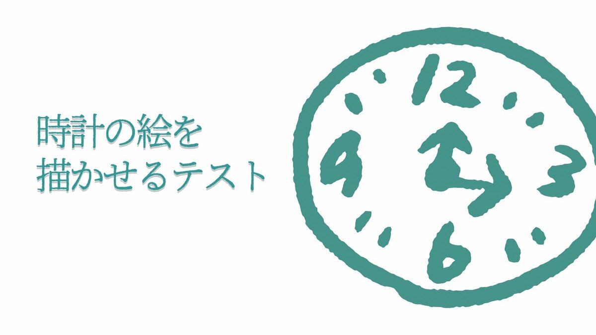 認知 ストア 症 時計 の 絵